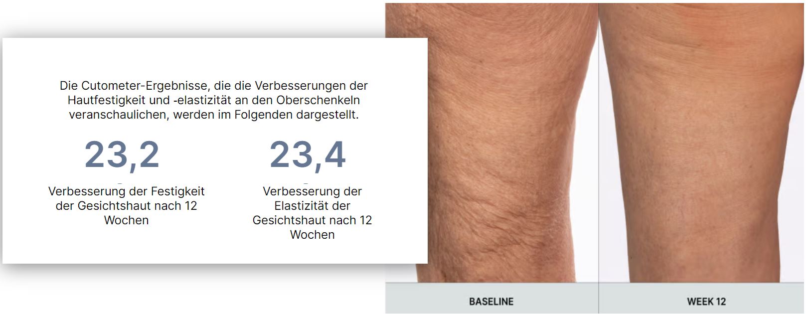Ergebnisse von WellSpa iO - straffere Haut