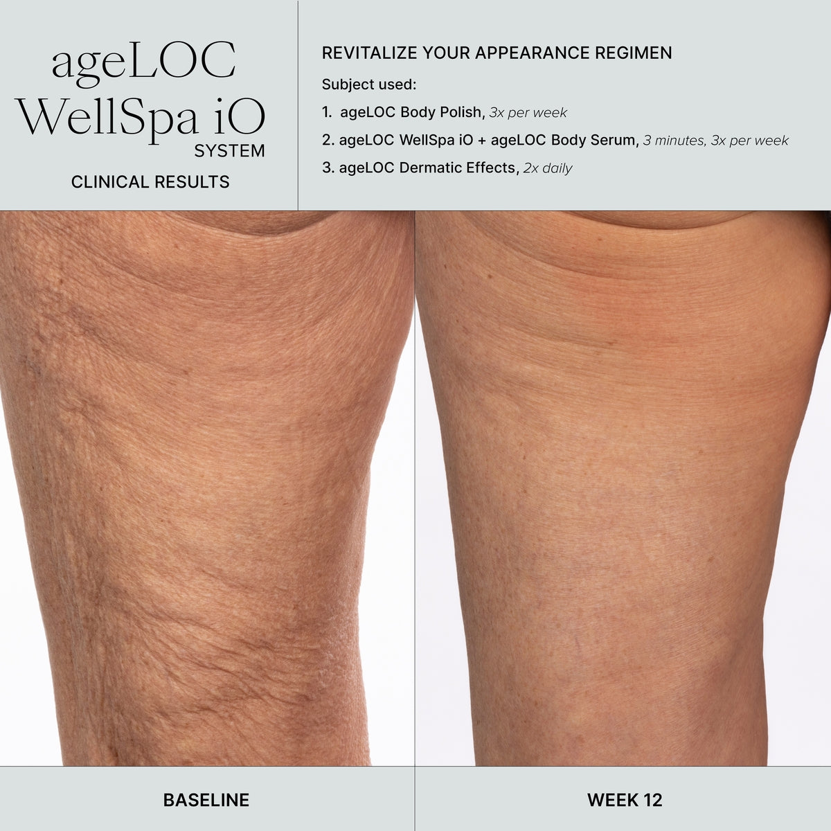 WellSpa iO Ergebnis