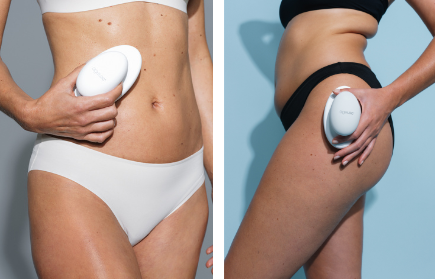 WellSpa iO von Nu Skin Hautstraffung Celllulite