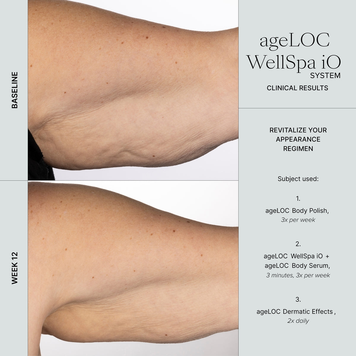 WellSpa iO before after