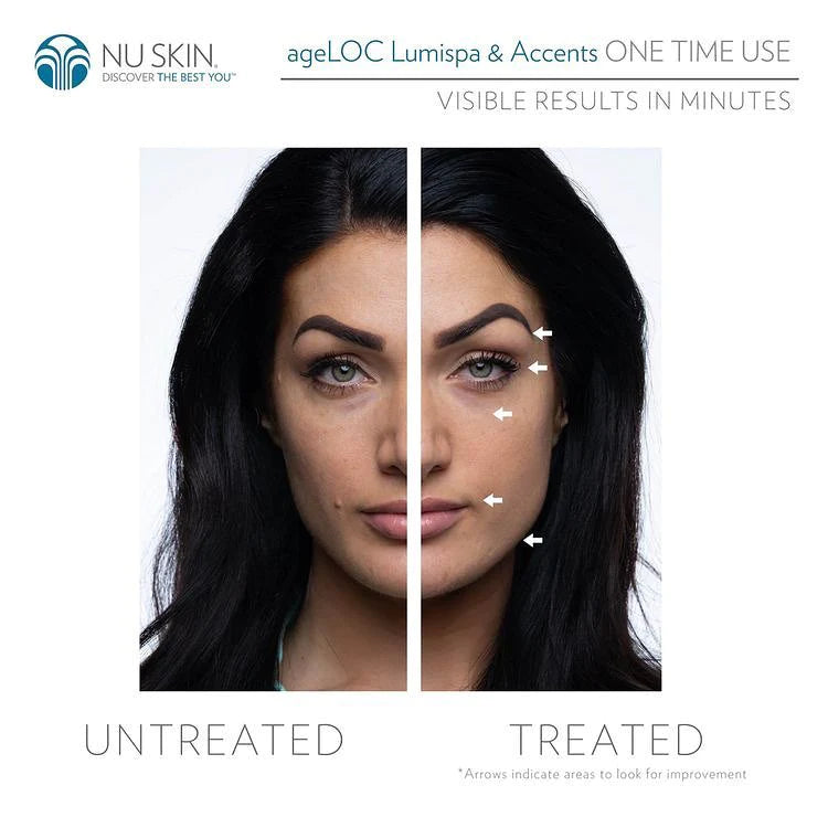 Foto antes - después - LumiSpa Accent eye care