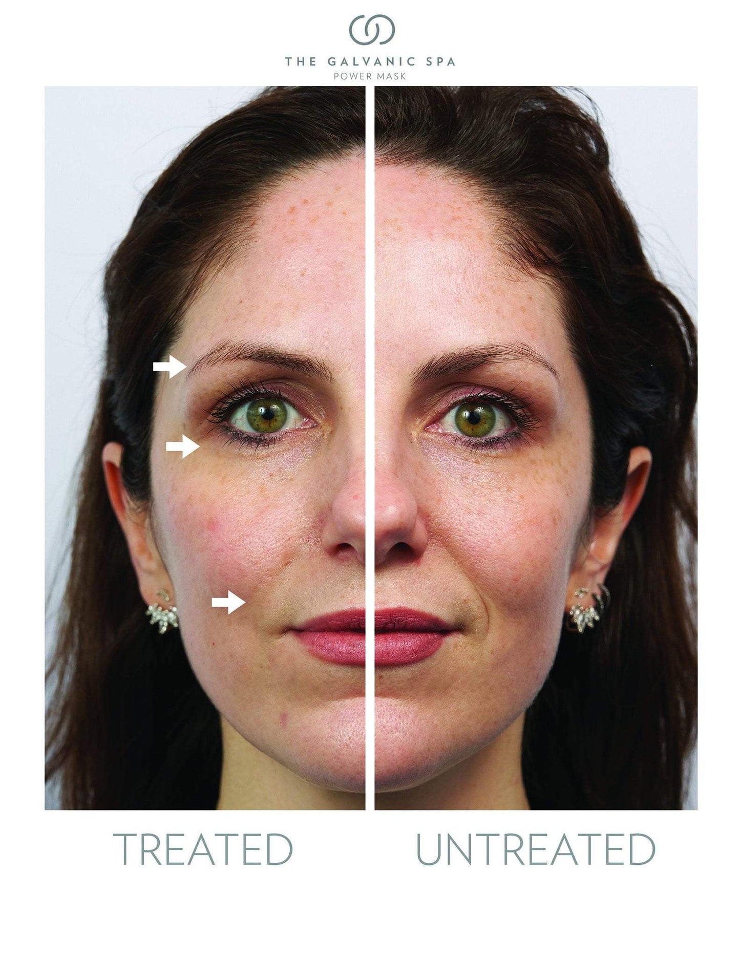 Dwie połówki twarzy kobieta leczona i nieleczona Galvanic Spa
