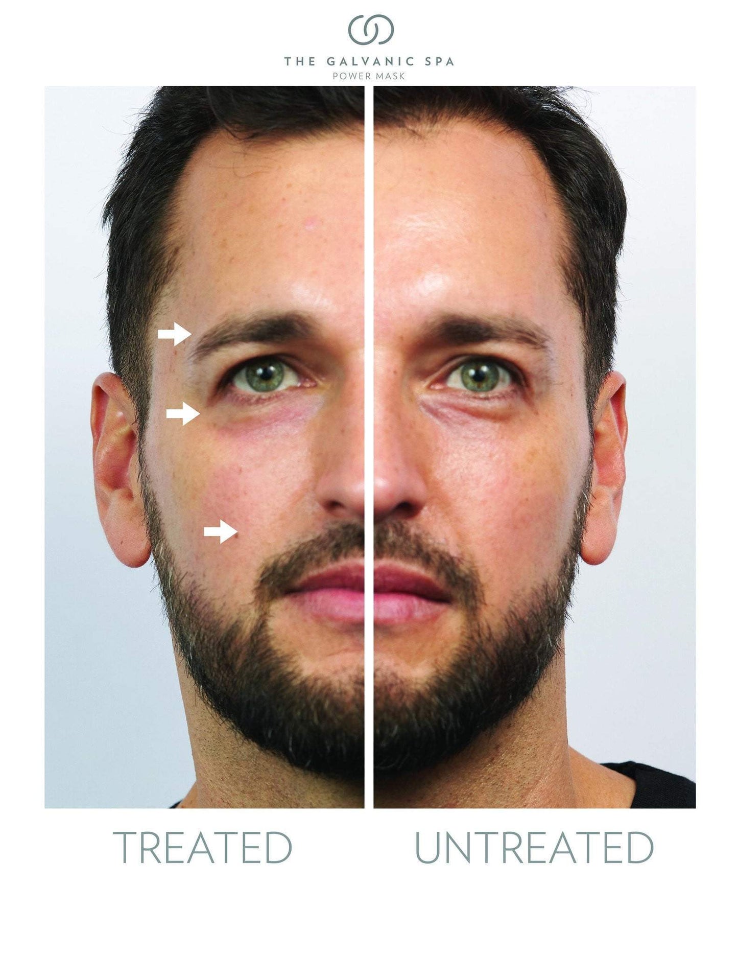 Two halves of the face man treated and untreated with Galvanic Spa